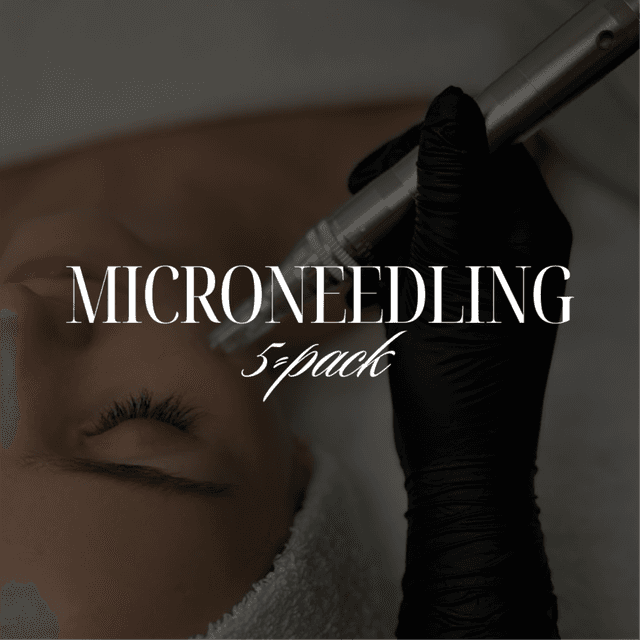 5-pack of Microneedling at Oak Esthetics in Peoria, AZ